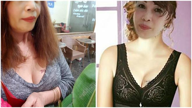 co dau 62 tuoi lien tuc khoe nguc ho tao bao, chong tre 26 phan ung bat ngo - 5