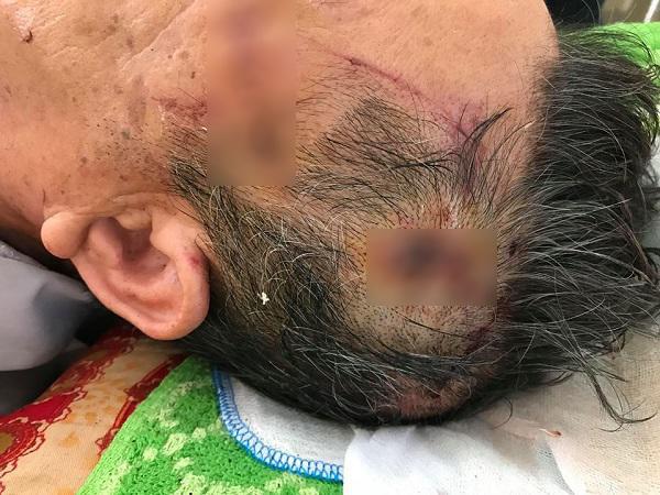 nhan chung giap mat nam thanh nien giet co giao o hung yen: “no doa neu keu len se giet” - 2