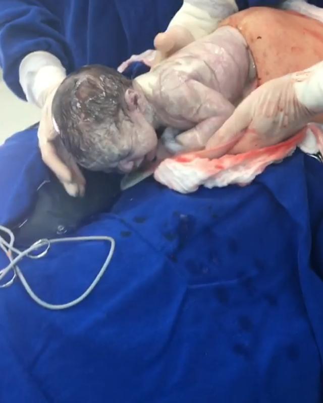 khoanh khac ky dieu: em be chui dau ra khoi bung me nhung boc oi van con nguyen - 2