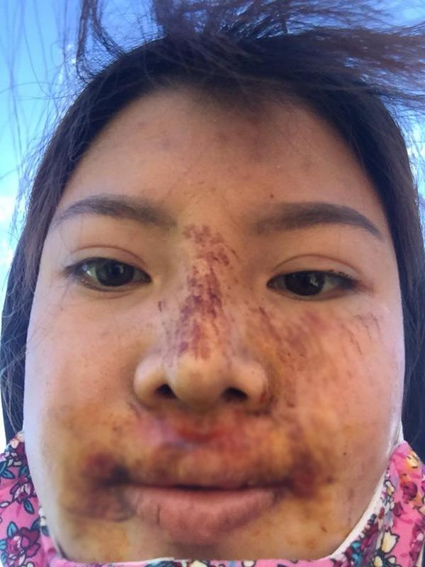 bi che xuong sac hau dao keo, phuong "thi no" khoe anh nhan sac thay doi chong mat - 3