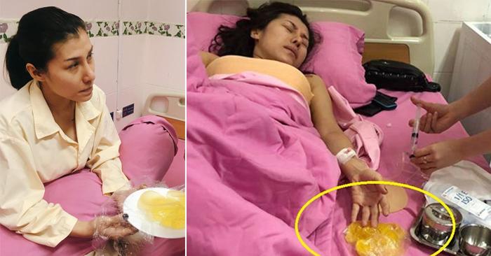 vua bi no tui nguc tren may bay gay chan dong, “thanh nu bolero” lai tiep tuc... bom silicon - 1