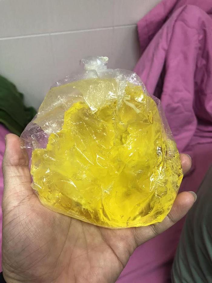 vua bi no tui nguc tren may bay gay chan dong, “thanh nu bolero” lai tiep tuc... bom silicon - 2
