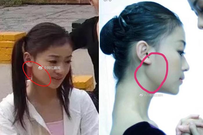noi tieng chua lau, nguy anh lac ngoai doi lo anh gay xau, bi to don cam got mat - 3