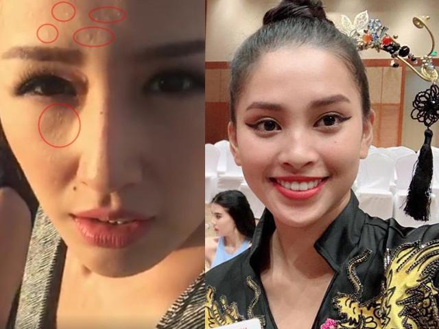 Tiểu Vy, Mai Phương Thuý và loạt mỹ nhân dù make-up kỹ càng vẫn lộ làn da chi chít mụn