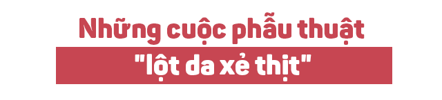 coi do kham nghia vu quan su bi nhin cham cham: con ac mong cua phu nu thai chuyen gioi - 6