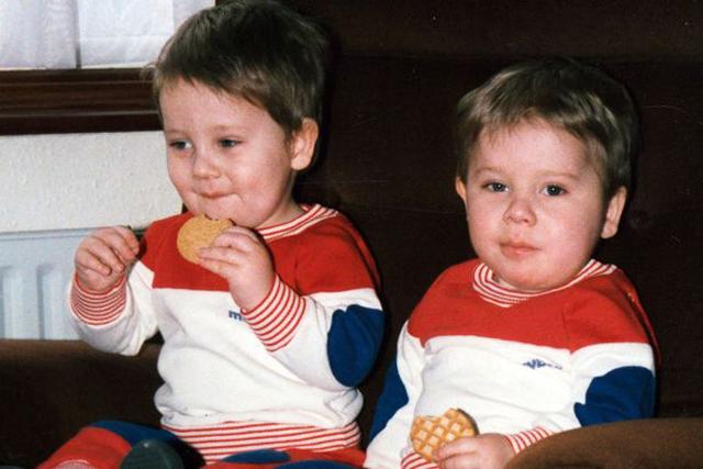 tung giong nhu 2 giot nuoc, can benh quai ac khien cap sinh doi khac nhau mai mai - 3