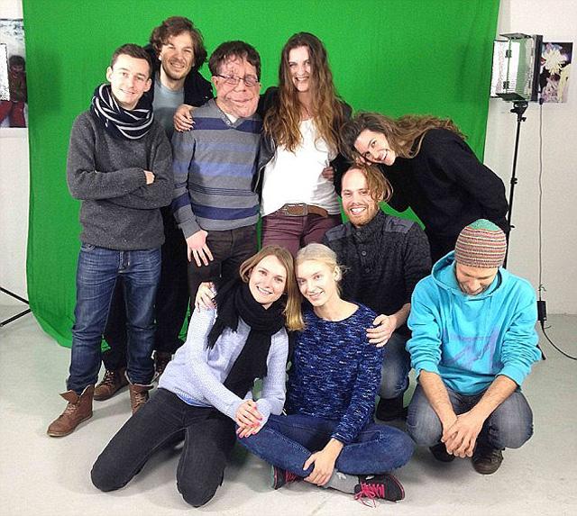 tung giong nhu 2 giot nuoc, can benh quai ac khien cap sinh doi khac nhau mai mai - 8