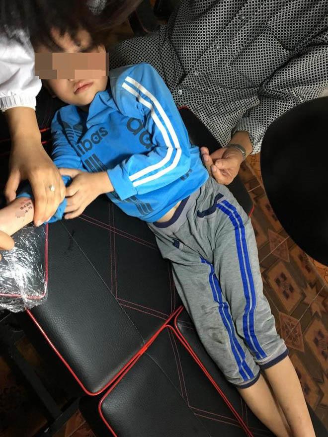 la lung ong dua chau nho di xam len canh tay, biet duoc ly do ai cung nin lang - 3