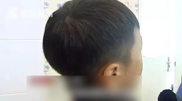 tin tuc 24h: so vao cho “nhay cam” cua co giao, be trai 7 tuoi bi danh bam tim mat - 1