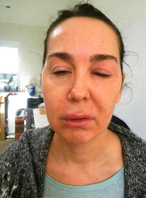 tre mai khong gia chang thay dau, nguoi phu nu "hoa" bai liet chi vi phuong phap lam dep nay - 3