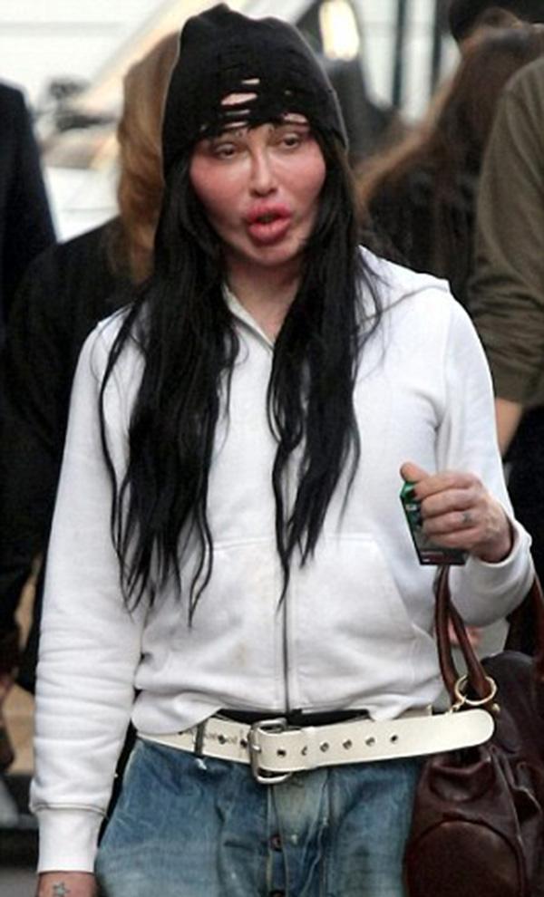 khuon mat bien dang, nam ca si tre qua doi sau hon 300 lan trung tu nhan sac - 6