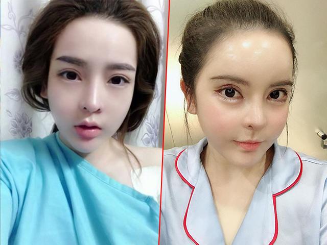 Xinh đẹp là thế, giờ đây chẳng ai nhận ra hotgirl đình đám một thời vì mặt như tượng sáp