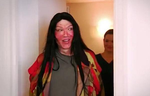 khuon mat bien dang, nam ca si tre qua doi sau hon 300 lan trung tu nhan sac - 5