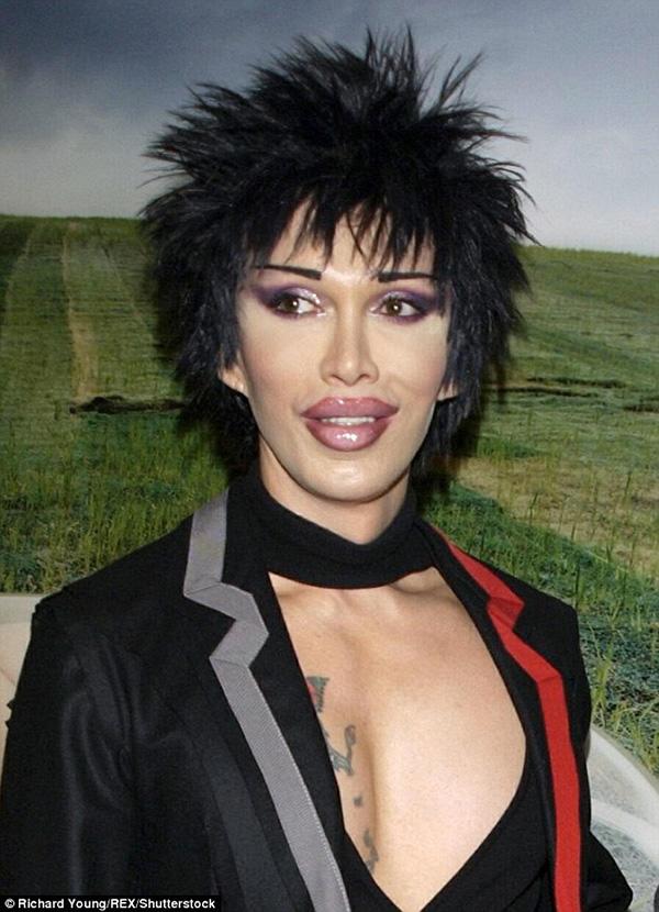 khuon mat bien dang, nam ca si tre qua doi sau hon 300 lan trung tu nhan sac - 4