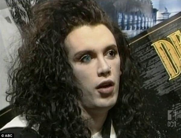 khuon mat bien dang, nam ca si tre qua doi sau hon 300 lan trung tu nhan sac - 2