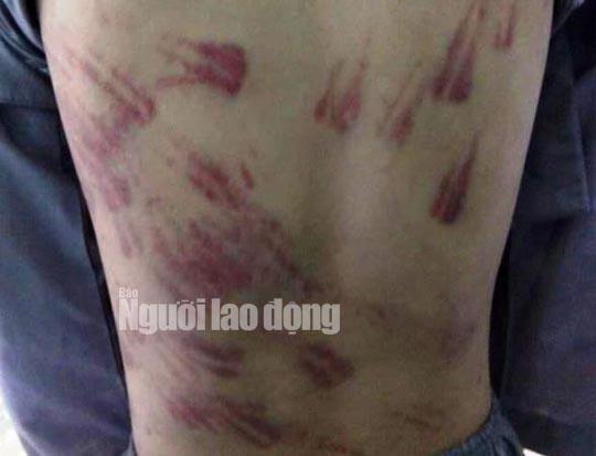 tran tinh cua su thay bao hanh be trai 10 tuoi mo coi tham tim khap nguoi - 1