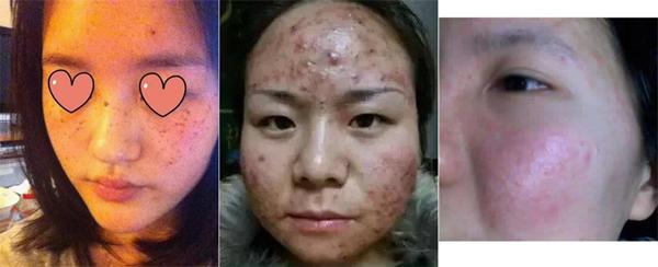 hai hung voi lan da lo loet vi su dung mat na giay, tat ca cung chi tai ham re - 4