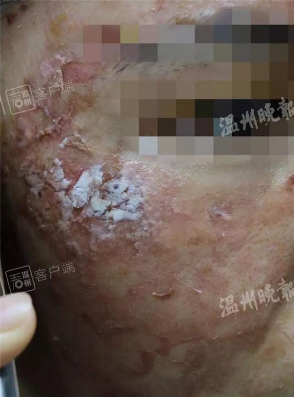hai hung voi lan da lo loet vi su dung mat na giay, tat ca cung chi tai ham re - 2