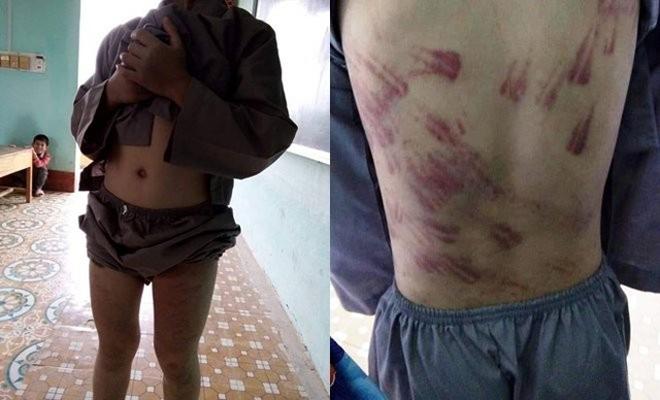 gia canh khon kho cua be trai 10 tuoi bi su tru tri danh bam tim khap co the - 1