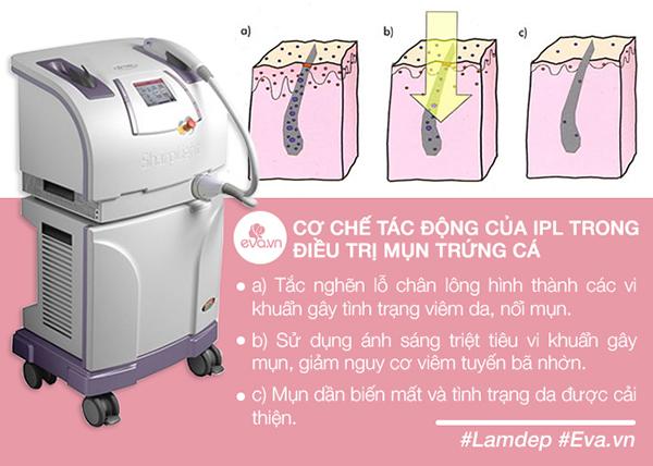 Mụn đỏ bay sạch, sẹo lồi, sẹo lõm không thành vấn đề chỉ với phương pháp này