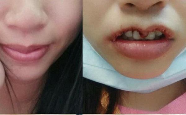 khi ban muon doi moi trai tim, con bac si lai muon khac nguyen hinh trai tim len mat ban... - 4