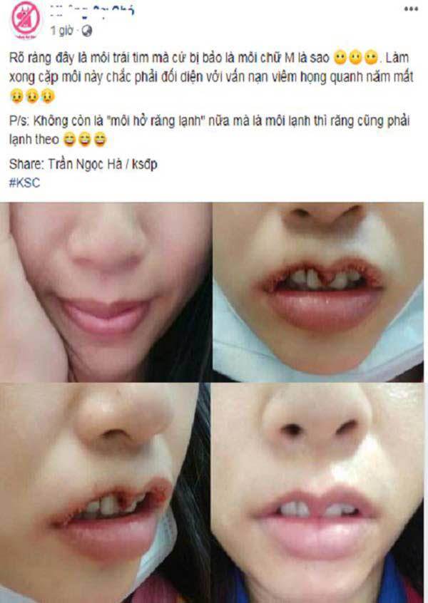 khi ban muon doi moi trai tim, con bac si lai muon khac nguyen hinh trai tim len mat ban... - 3