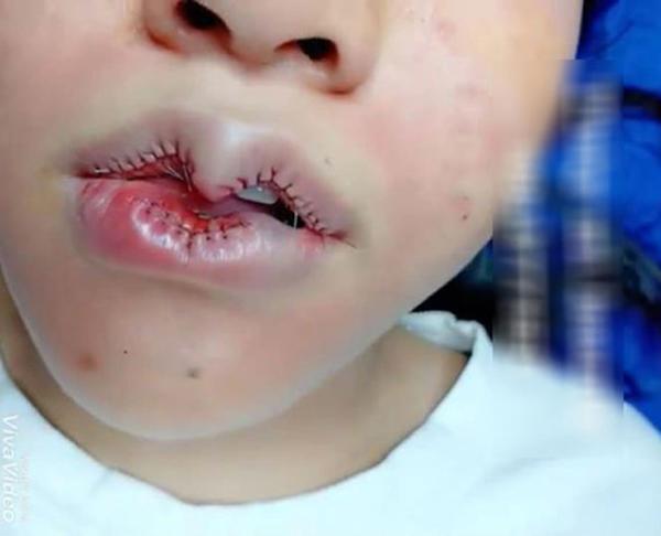 khi ban muon doi moi trai tim, con bac si lai muon khac nguyen hinh trai tim len mat ban... - 6