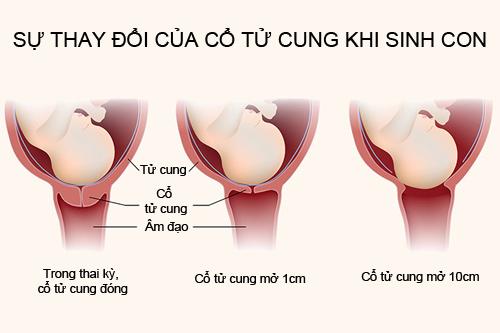 Mang thai: Quá trình cổ tử cung mở từ 1cm-10cm khi đẻ thường diễn ...