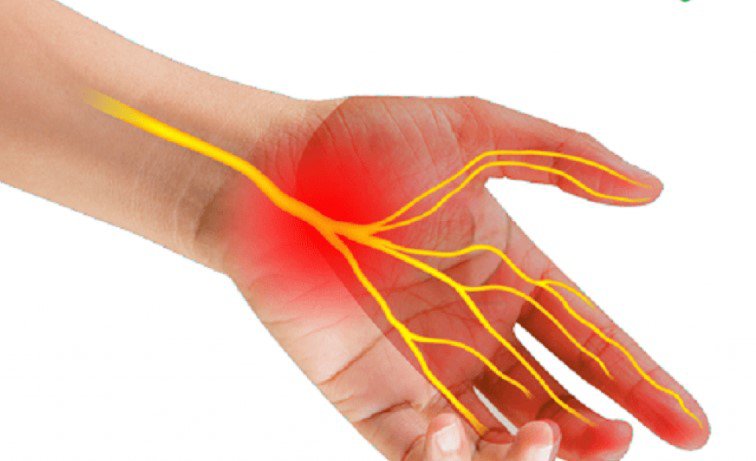Bà bầu bị tê tay là do đâu, xử lý thế nào tốt nhất? - 3