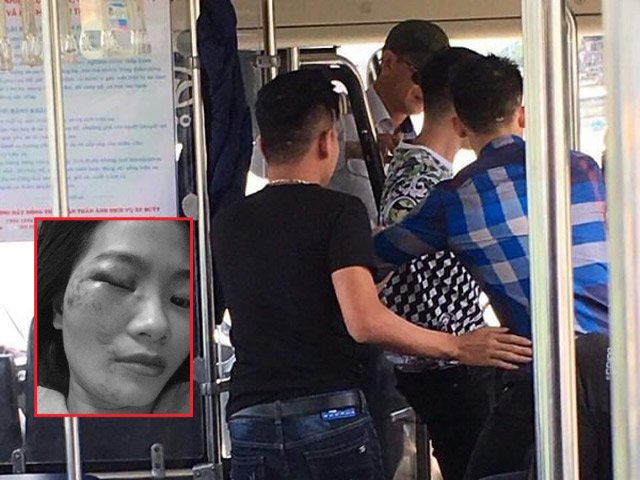Nhắc khách không nói tục, nữ phụ xe buýt bị 4 thanh niên đánh bầm giập mặt đúng ngày 20/10