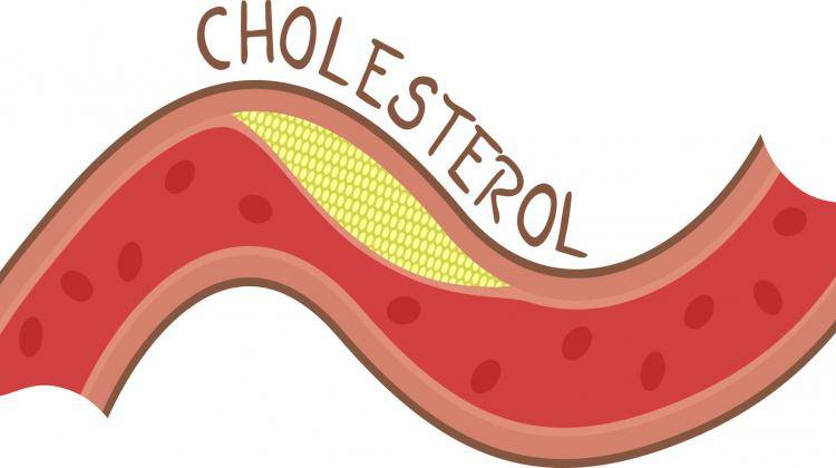 Những điều cần biết về cholesterol