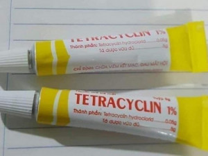 Khô hanh kéo dài nhiều người dùng thuốc mỡ Tetracyclin trị nẻ da: Có nên hay không