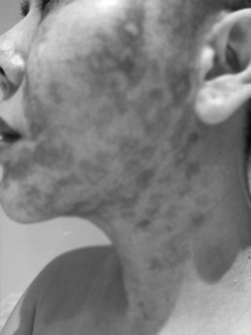 Đầu tư tiền làm trẻ hóa căng da, người phụ nữ bị bỏng rộp hết khuôn mặt - 9