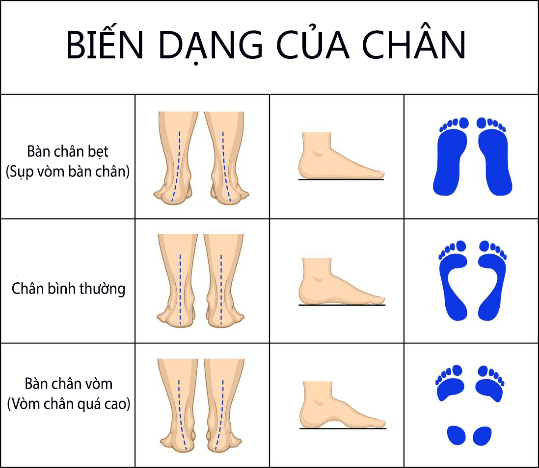 Trẻ có 2 đặc điểm này ở chân tương lai cao vượt trội nhưng 4 điều này lại nguy hiểm - 5