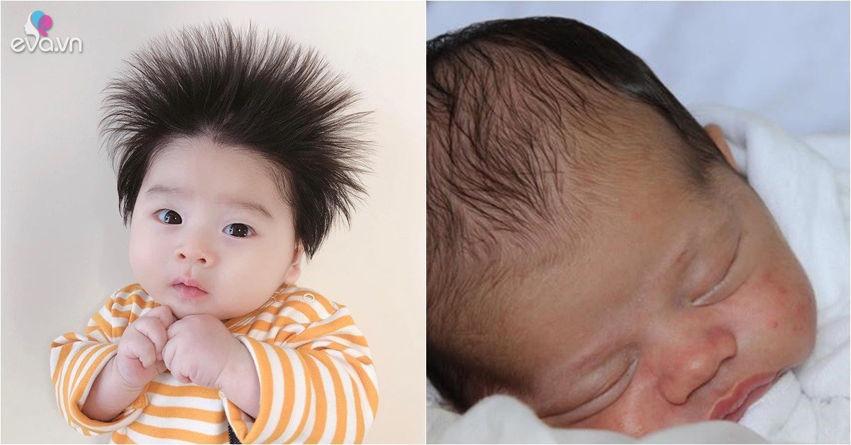 3 lý do khiến tóc trẻ sơ sinh bị dựng đứng không phải do vuốt ngược mà coi chừng thiếu chất #4 3 lý do khiến tóc trẻ sơ sinh bị dựng đứng không phải do vuốt ngược mà coi chừng thiếu chất