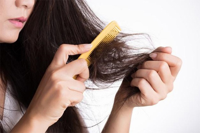 Lý giải nguyên nhân dẫn đến rụng tóc nhiều ở tuổi 16