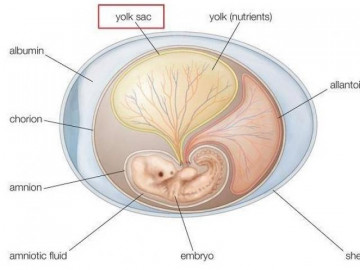 Yolksac bị giãn nở là dấu hiệu của tình trạng gì trong thai kỳ?  
