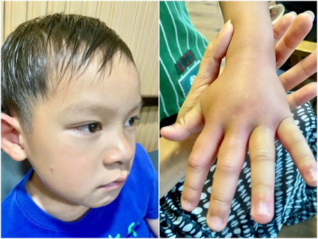 Con trai gặp nạn sưng mặt, phù tay ở nông trại nghìn m2, Lý Hải Minh Hà lên mạng cầu cứu