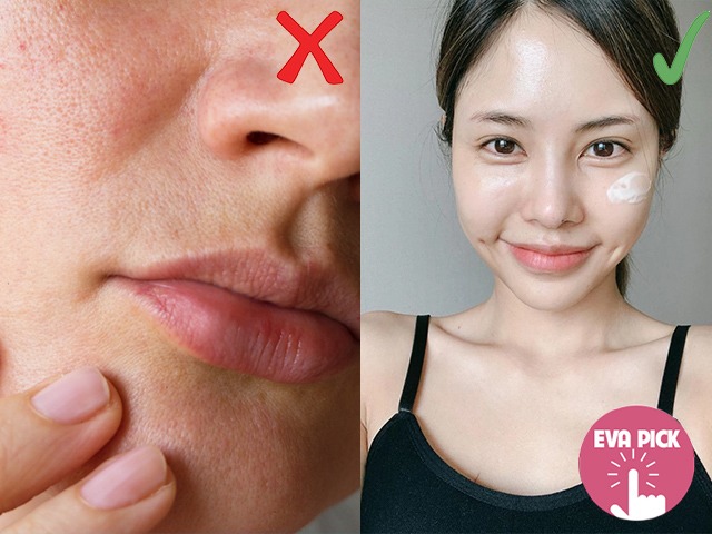 7 cách chăm sóc da mùa Đông ai không biết dễ già trước tuổi vì da mặt khô queo