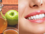 8 Cách làm trắng răng bị vàng ố tại nhà an toàn, hiệu quả