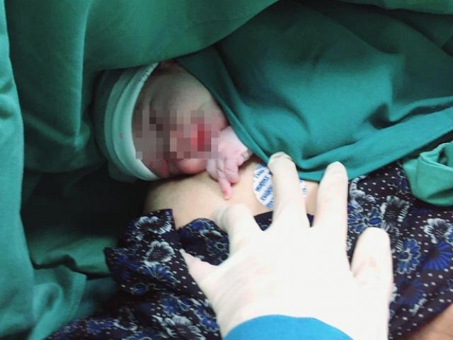 Mẹ bầu 41 tuổi nhập viện, bác sĩ nín thở mổ lấy thai sợ gãy tay, chân em bé