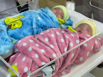 Lần đầu tiên ở Việt Nam: Cứu sống cặp song sinh chào đời ở tuần thai 25, chỉ nặng 500gram