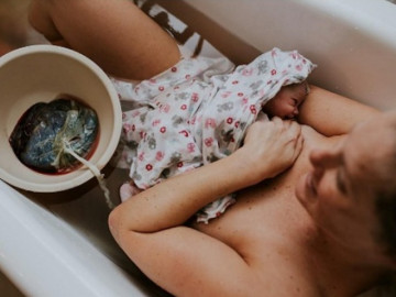 Không cắt dây rốn cho trẻ sơ sinh để giữ lại tối đa dưỡng chất: Nguy hiểm khi nhau thai để lâu bên ngoài