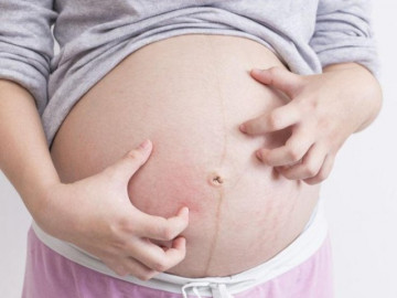 Mẹ bầu có 7 đặc điểm này sẽ dễ đẻ thường, con sinh ra khỏe mạnh ít gặp biến chứng