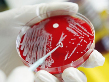Có trẻ nhỏ mắc, tử vong vì nhiễm “vi khuẩn ăn thịt người”, cần làm gì để phòng bệnh này tuyệt đối?