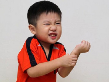 Bé 6 tuổi Hà Nội sốt trên 40 độ, sốc nhiễm khuẩn vì hành động ai cũng làm sau khi bị muỗi đốt