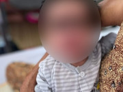 Bà bầu - Cứu sống bé 16 ngày tuổi sốt cao, rốn lồi lên do mẹ không tiêm ngừa trong thai kỳ