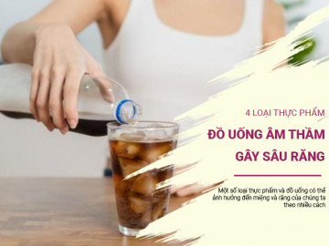 4 loại thực phẩm và đồ uống âm thầm gây sâu răng mà bạn không ngờ tới